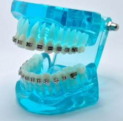 Model typodont orto albastru cu bracketi metalici 