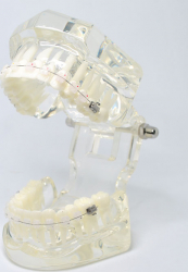 Model typodont orto transparent cu bracketi ceramici 