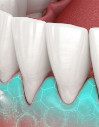 Irigator oral Lanaform Hydrojet portabil reincarcabil 3 moduri curatare rotatie 360 grade 