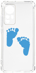 Husa BestCase Compatibila Cu Xiaomi 12 Pro Boy Feet Print 1.5MM Slim Anti Shock AS 960 
