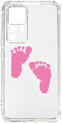 Husa BestCase Compatibila Cu Xiaomi 12T Pro Girl Feet Print 1.5MM Slim Anti Shock AS 961 