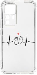 Husa BestCase Compatibila Cu Xiaomi 12T Pro My Little Love 1.5MM Slim Anti Shock AS 966 