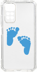 Husa BestCase Compatibila Cu Xiaomi Redmi Note 11s 4G Boy Feet Print 1.5MM Slim Anti Shock AS 960 