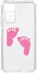 Husa BestCase Compatibila Cu Xiaomi Redmi Note 11s 4G Girl Feet Print 1.5MM Slim Anti Shock AS 961 