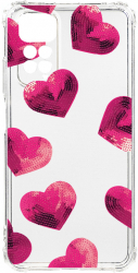 Husa BestCase Compatibila Cu Xiaomi Redmi Note 11s 4G Heart Pattern 1.5MM Slim Anti Shock AS 987 