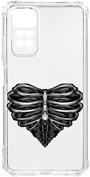 Husa BestCase Compatibila Cu Xiaomi Redmi Note 11s 4G Skeleton Heart 1.5MM Slim Anti Shock AS 1024 