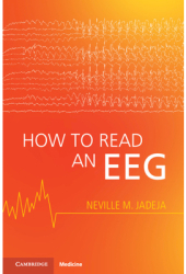 How to Read an Eeg - Neville M Jadeja Author 