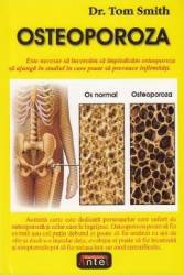 Osteoporoza - Tom Smith 